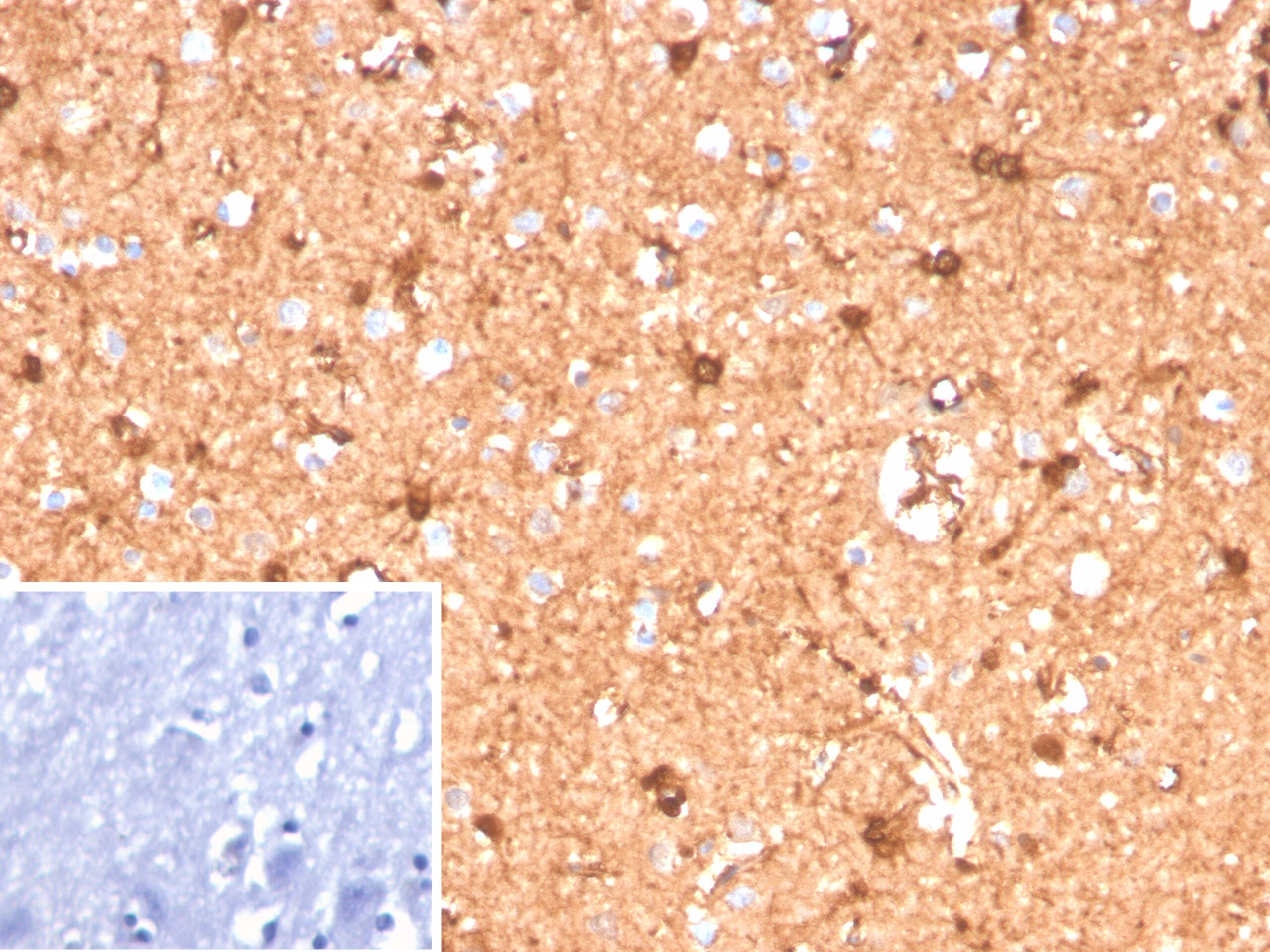 S100B Antibody (S100B/12587R)