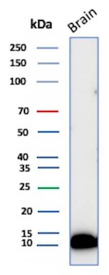 S100B Antibody (S100B/12587R)