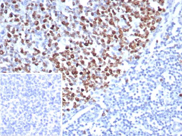 TOP2A Antibody (rTOP2A/8339)