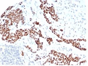 WT1 Antibody (rWT1/6908)