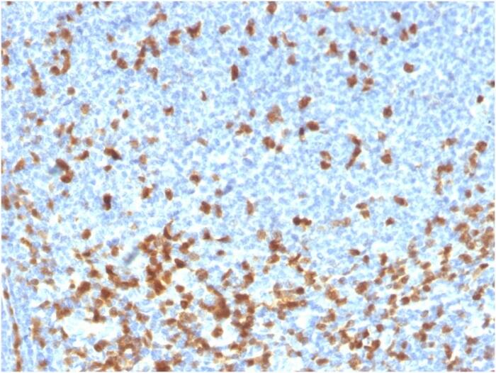 ZAP70 Antibody (rZAP70/2046)