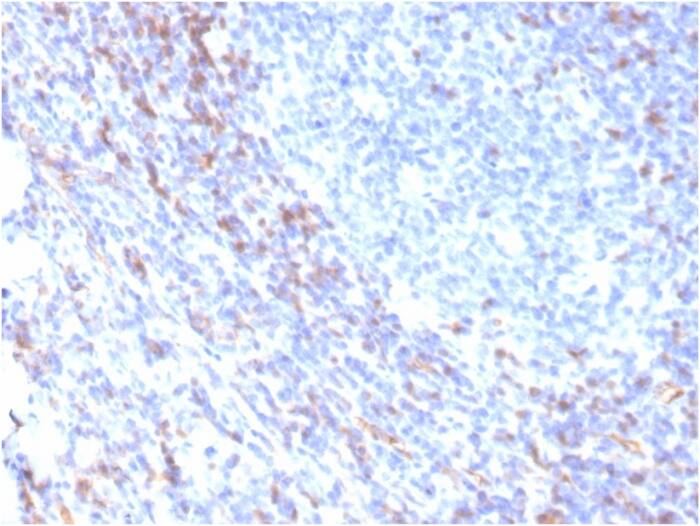 ZAP70 Antibody (rZAP70/2046)