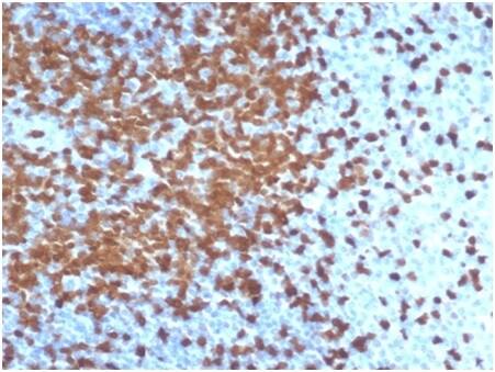 ZAP70 Antibody (ZAP70/6492R)