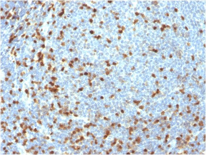 ZAP70 Antibody (ZAP70/3921R)