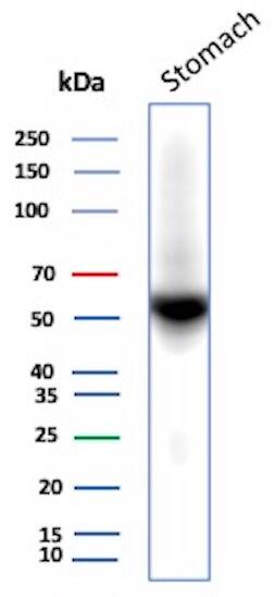 Carbonic Anhydrase IX/CA9 Antibody (rCA9/9937)