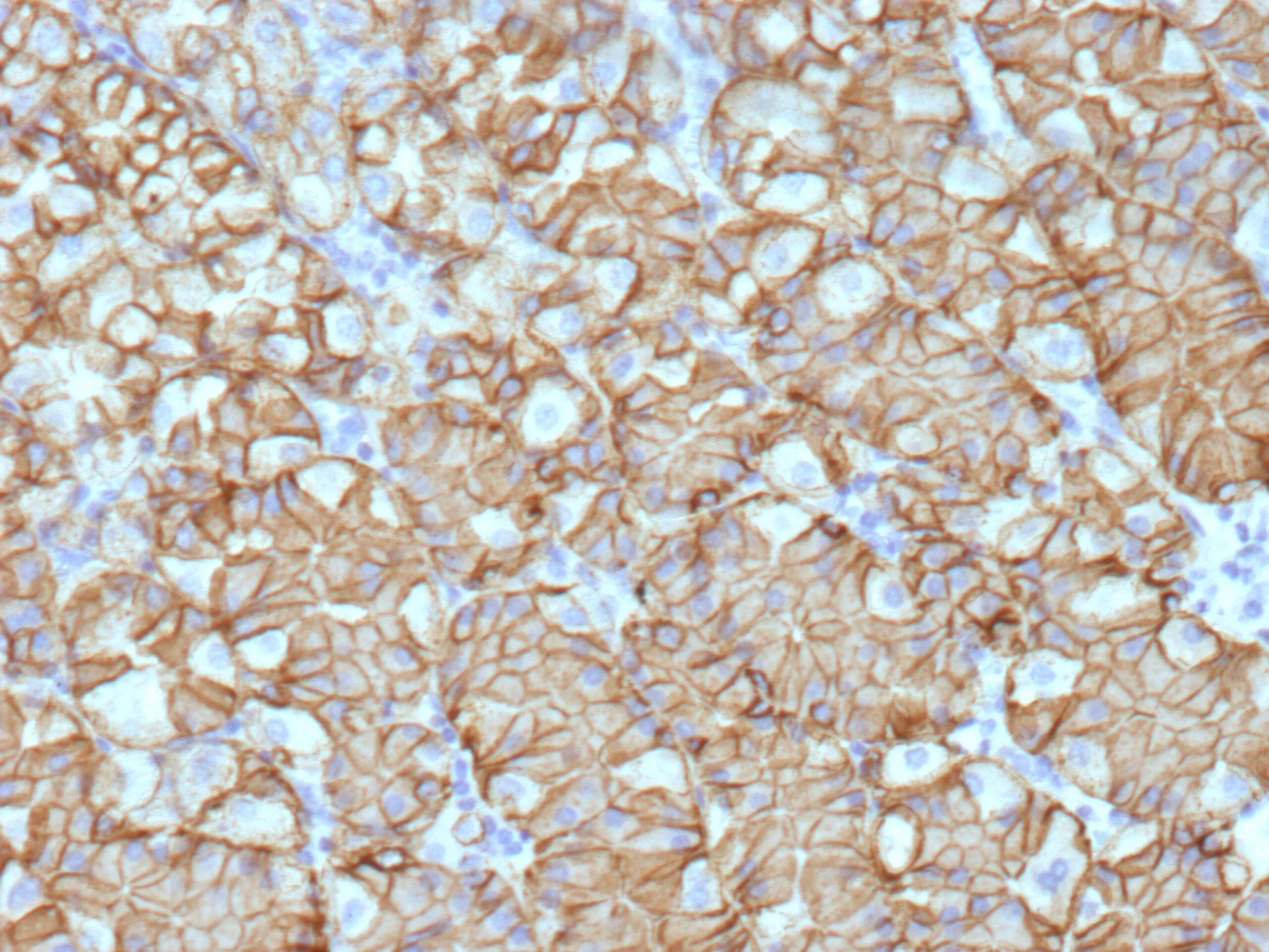 Carbonic Anhydrase IX/CA9 Antibody (CA9/9621R)