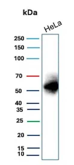 Carbonic Anhydrase IX/CA9 Antibody (CA9/9621R)