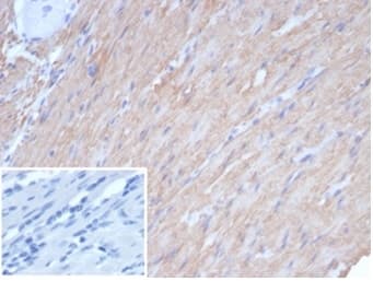 Caldesmon/CALD1 Antibody (rCALD1/7266)