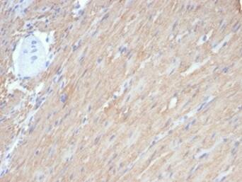 Caldesmon/CALD1 Antibody (rCALD1/7266)