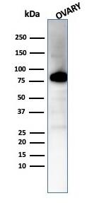 Caldesmon/CALD1 Antibody (CALD1/7024R)