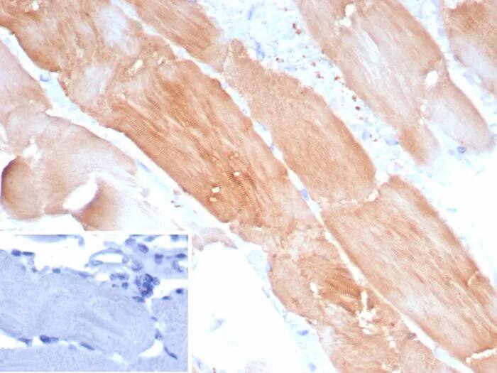 Alpha Actinin 2 Antibody (ACTN2/8184R)