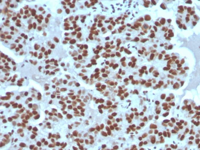 Cyclin E1 Antibody (rCCNE1/4936)