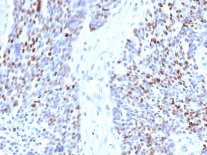 Cyclin E1 Antibody (rCCNE1/4936)