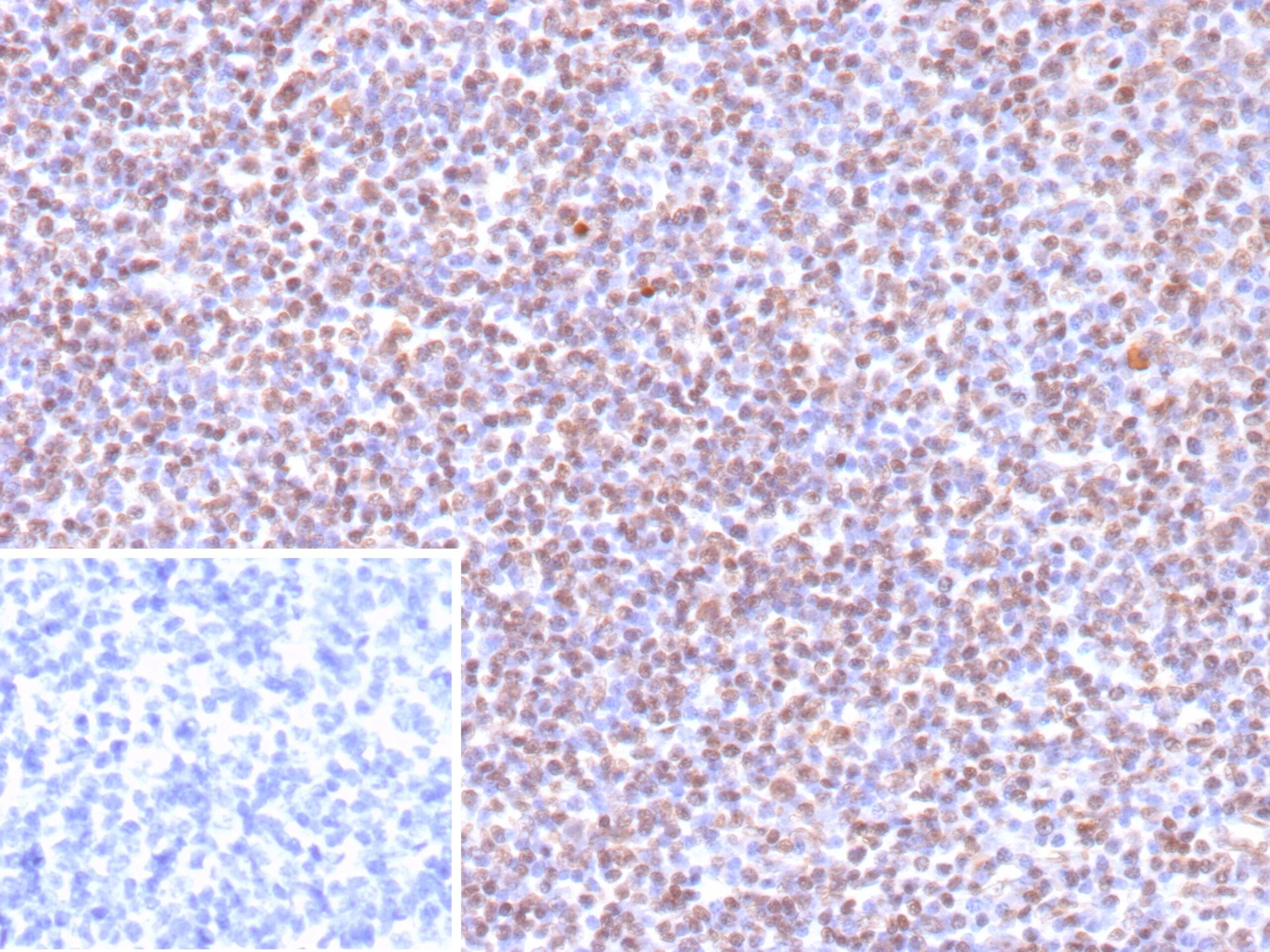 Epstein Barr Virus Antibody (EBV/9619R)