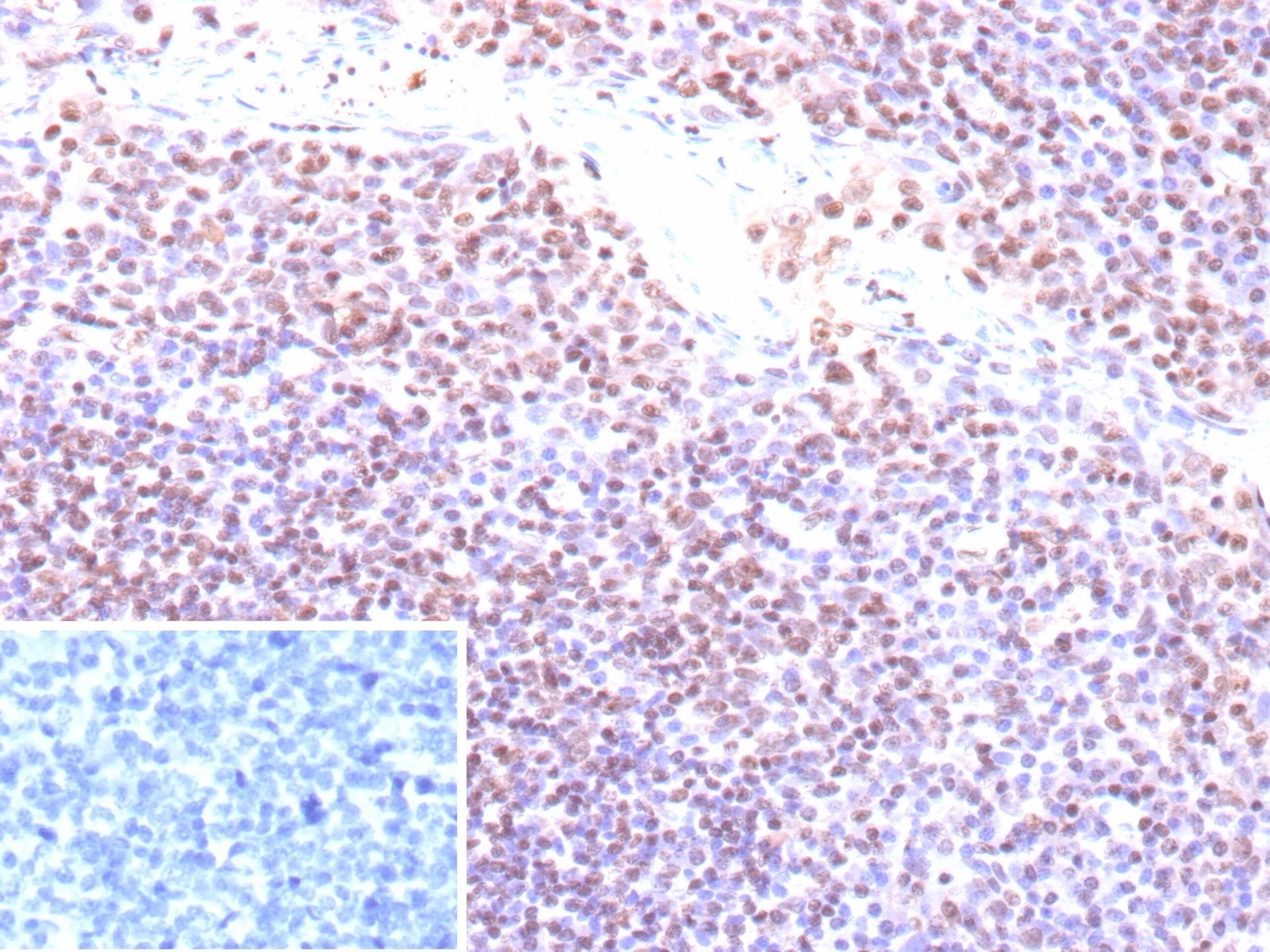 Epstein Barr Virus Antibody (EBV/9620R)