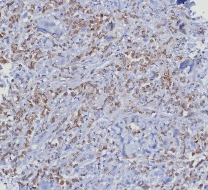 CDK4 Antibody (CDK4/8351R)