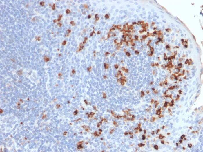 Kappa Light Chain Antibody (rKLC264)