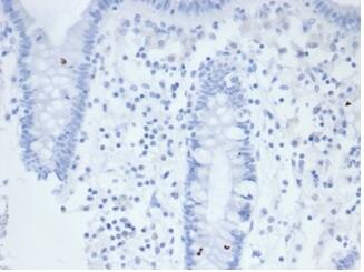 Alkaline Phosphatase/ALPP/ALPI Antibody (rALP/870)