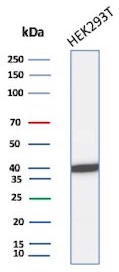 Creatine Kinase BB Antibody (rCKBB/8841)
