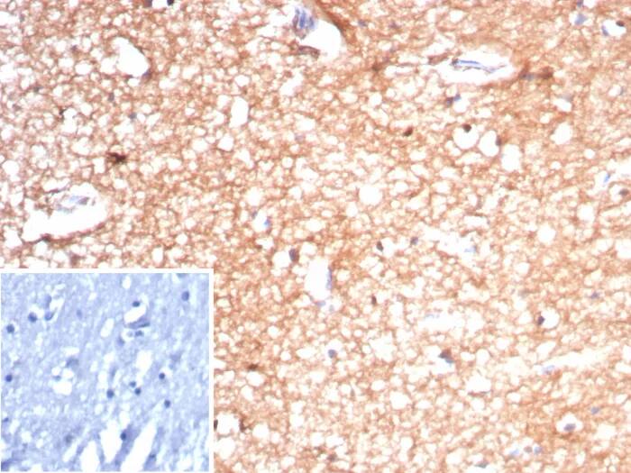 Creatine Kinase BB Antibody (rCKBB/8842)