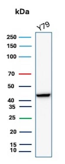 Creatine Kinase BB Antibody (rCKBB/8842)