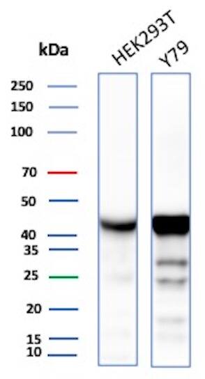 Creatine Kinase BB Antibody (rCKBB/8842)