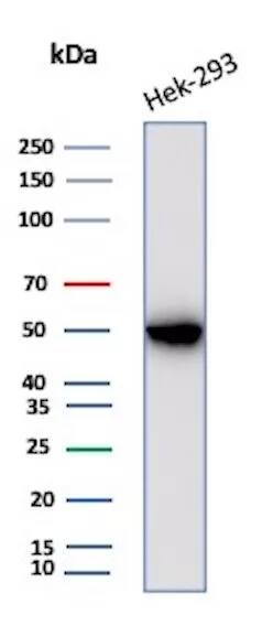 Creatine Kinase BB Antibody (CKBB/8306R)