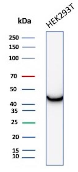 Creatine Kinase BB Antibody (CKBB/8306R)
