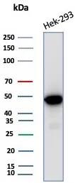 Creatine Kinase BB Antibody (CKBB/8310R)