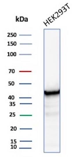 Creatine Kinase BB Antibody (CKBB/8608R)