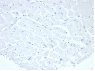 Alkaline Phosphatase/ALPP/ALPI Antibody (rALP/870)