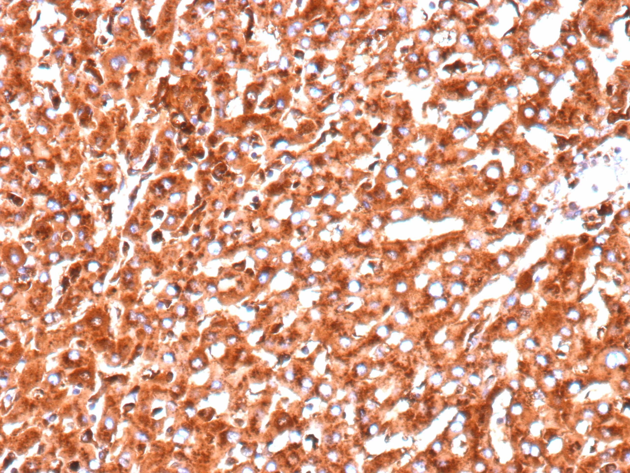 Cathepsin D Antibody (CTSD/9613R)