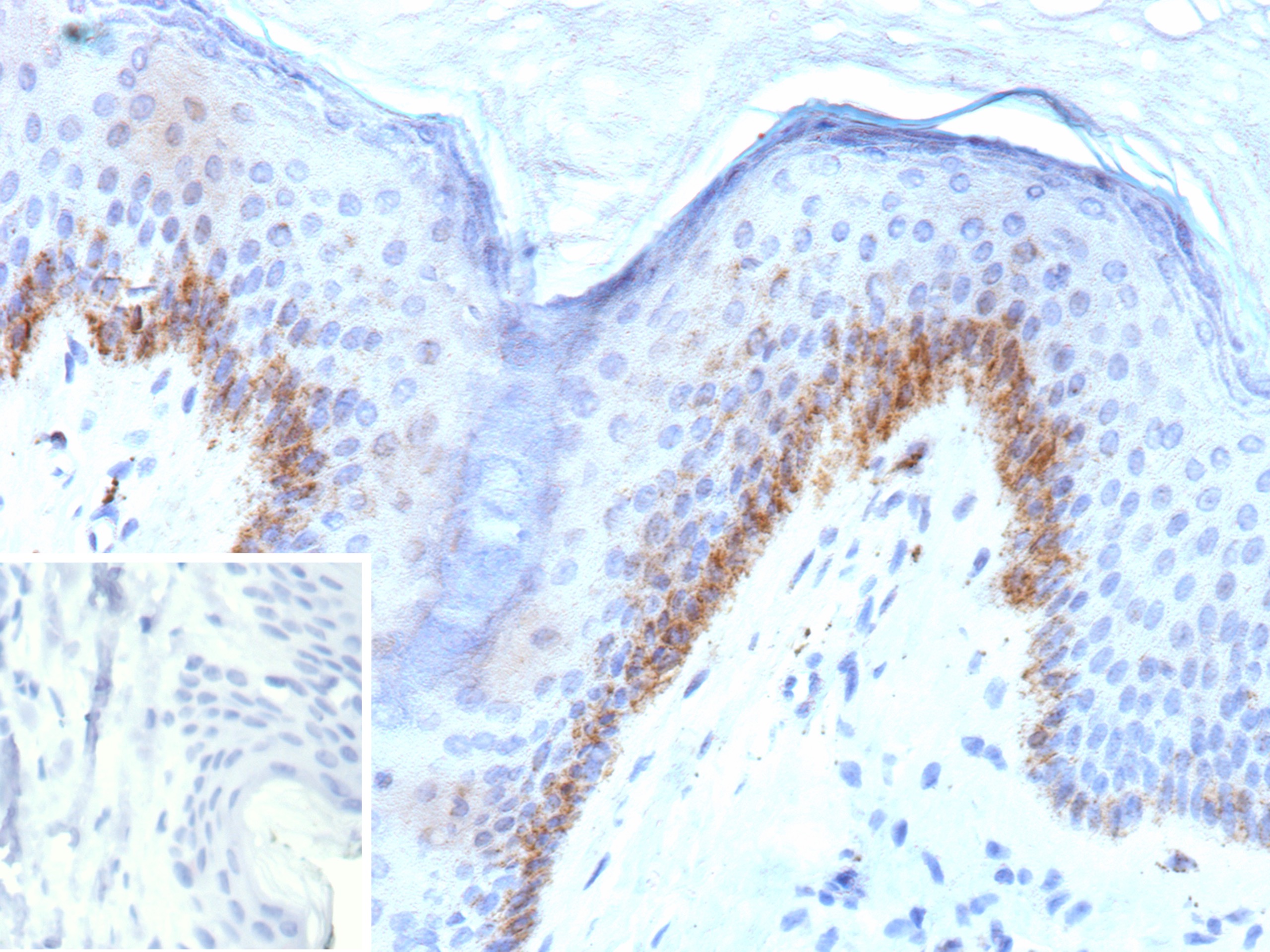 Kallikrein 4/Prostase/EMSP1 Antibody (KLK4/8943)