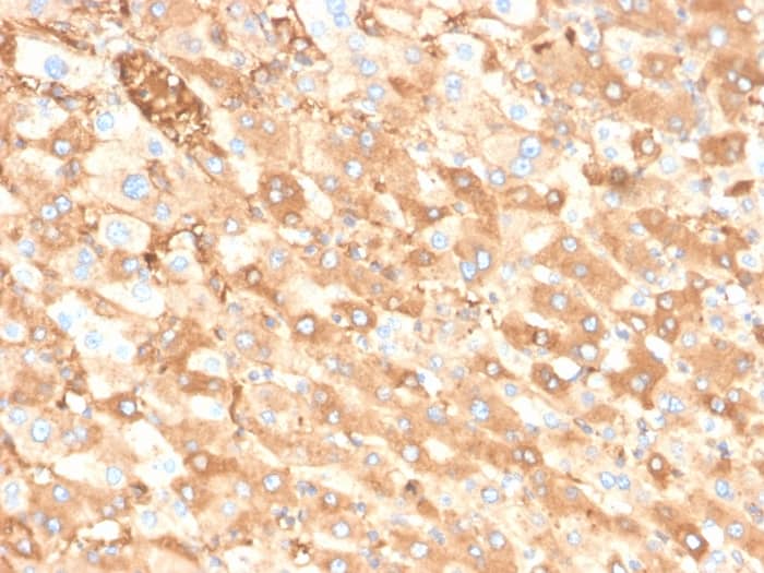 Albumin Antibody (ALB/6413R)
