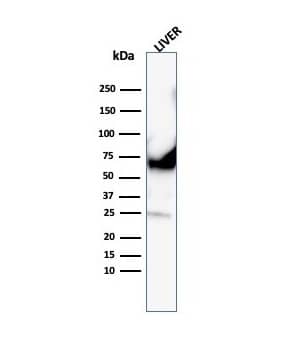 Albumin Antibody (ALB/6413R)