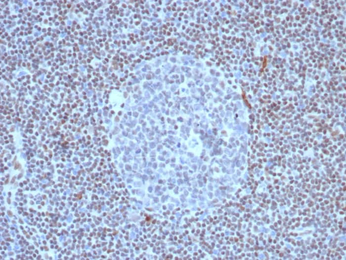 FLI1 Antibody (FLI1/8318R)