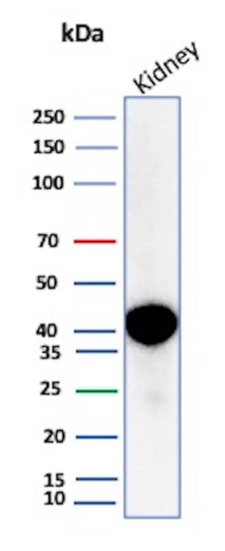 alpha-Methylacyl-CoA Racemase/AMACR Antibody (AMACR/2748R)