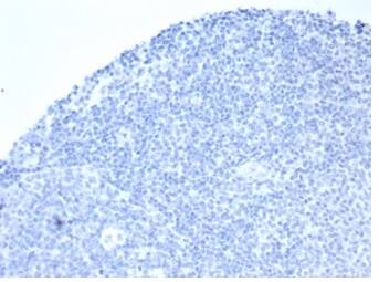 Alkaline Phosphatase/ALPP/ALPI Antibody (rALP/870)