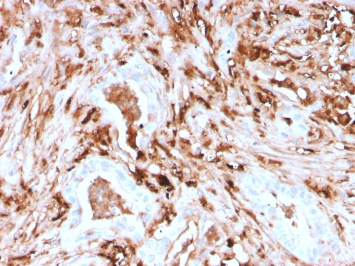 Ferritin Light Chain Antibody (rFTL/1388)