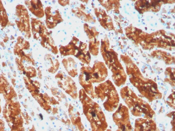Ferritin Light Chain Antibody (rFTL/1386)