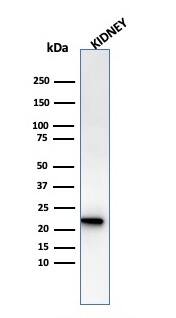 Ferritin Light Chain Antibody (rFTL/1386)