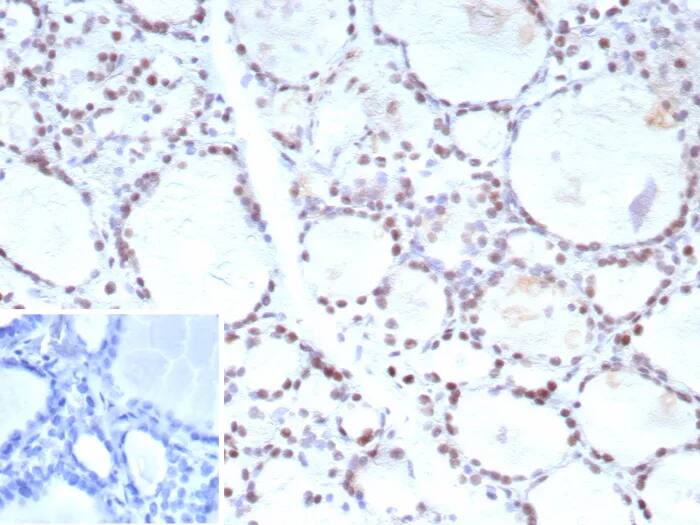 FoxP1 Antibody (FOXP1/9381R)