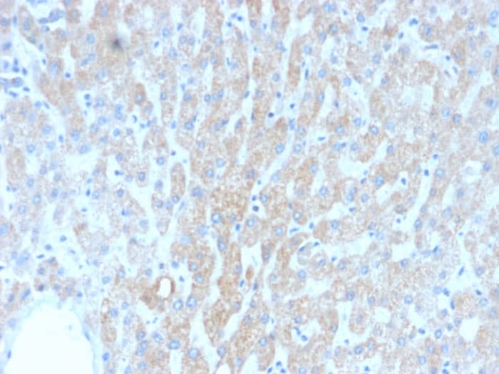 HSP60 Antibody (rGROEL/780)
