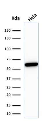 HSP60 Antibody (rGROEL/780)