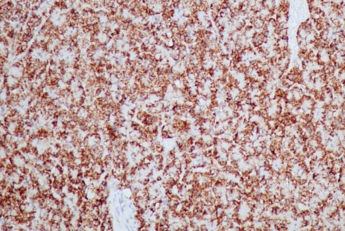 HSP60 Antibody (HSPD1/2206R)