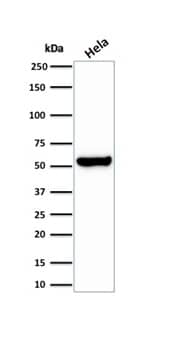 HSP60 Antibody (HSPD1/2206R)