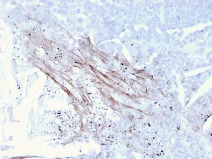 Tenascin C Antibody (rTNC/3635)
