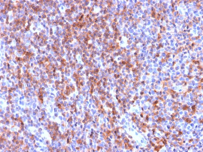 ICAM-3/CD50 Antibody (ICAM3/2873R)