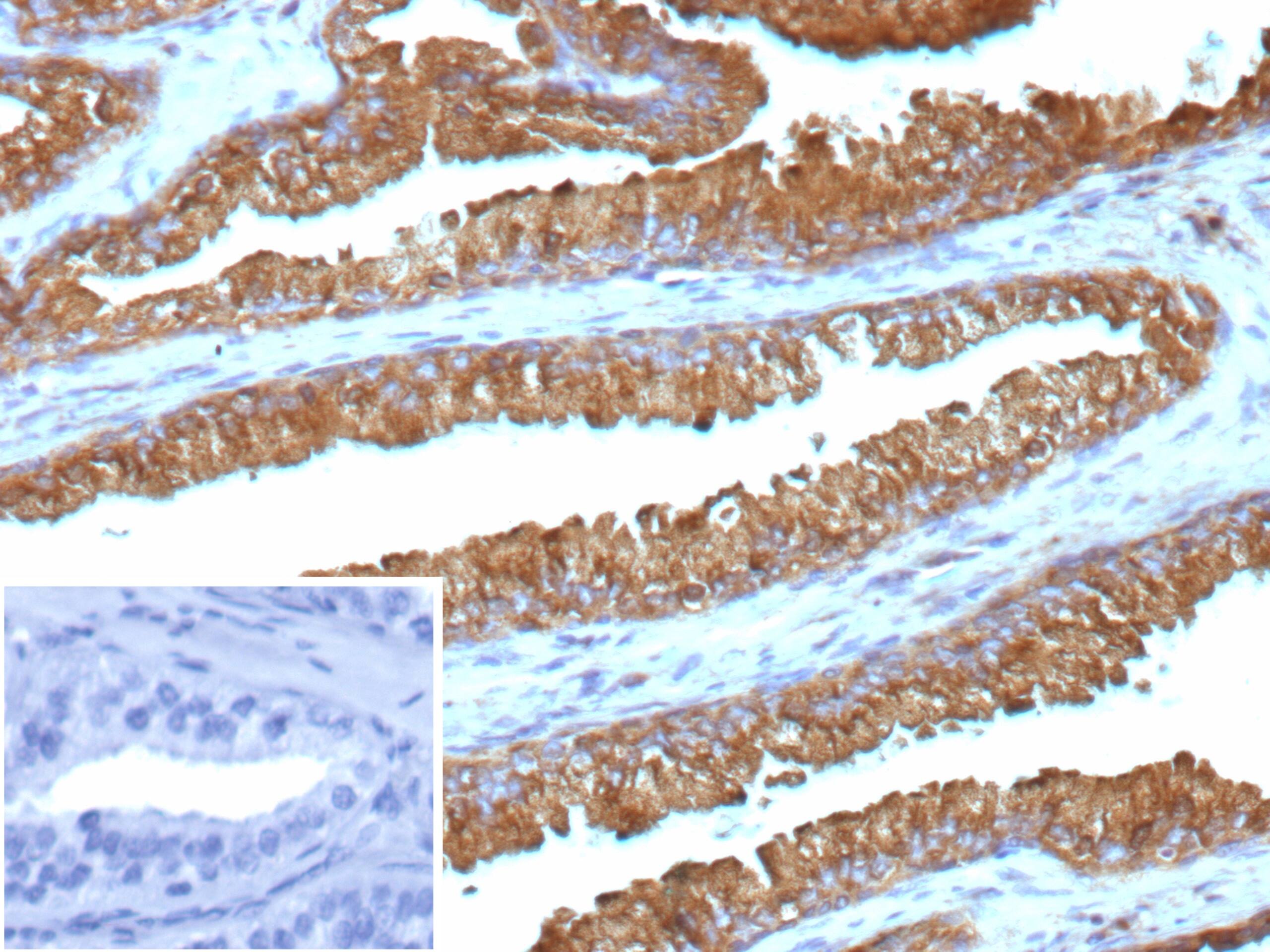 Isocitrate Dehydrogenase 1/IDH1 Antibody (IDH1.R132G/13054R)