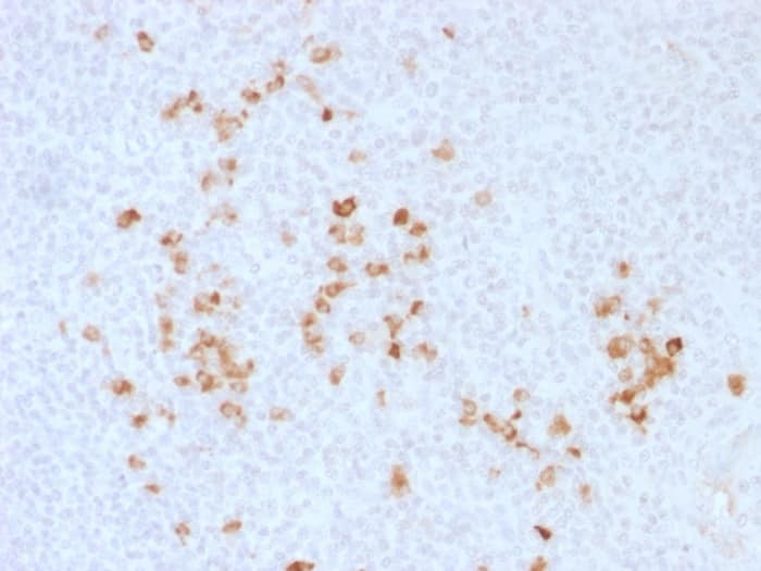 IgG Antibody
